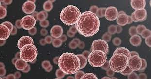 Scientists advance understanding of metastasis, cancer cells exposed to high viscosity