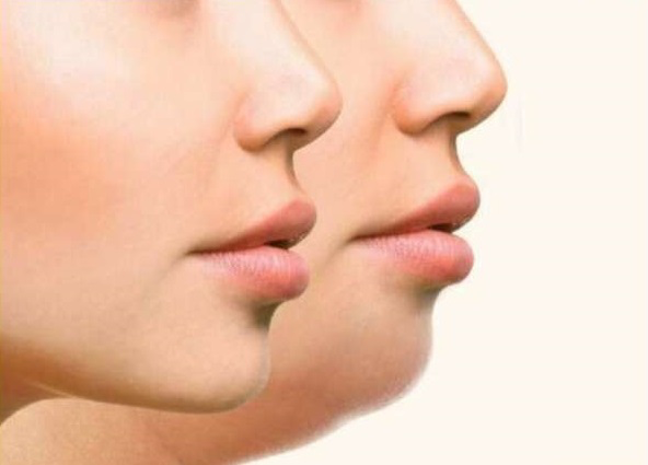 सेहत : फेस फैट