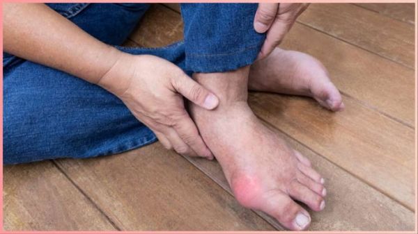 सेहत: क्या हाई यूरिक एसिड के मरीजों को खाना चाहिए समोसा?