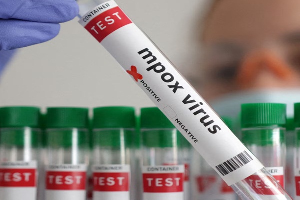 जाम्बिया में एमपॉक्स से दूसरी मौत, मामले बढ़कर 49 हुए