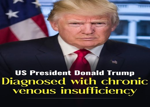 अमेरिकी राष्ट्रपति को क्रोनिक वेनस इनसफिशिएंसी की पुष्टि, अन्य स्वास्थ्य रिपोर्ट सामान्य