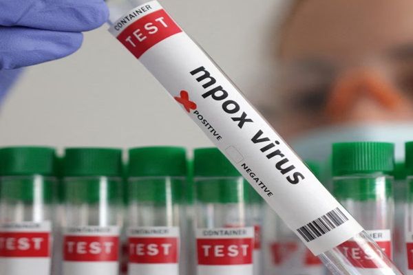 जाम्बिया में एमपॉक्स से दूसरी मौत, मामले बढ़कर 49 हुए