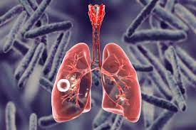 देश में दस लाख से अधिक टीबी मरीजों के सहयोग के लिए 71,000 से अधिक निक्षय मित्र आए आगे