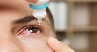 उत्&zwj;तर भारत में कंजक्टिवाइटिस के बढ़ते मामले के बीच एम्स के चिकित्सकों ने स्टेरॉयड के इस्तेमाल को लेकर चेतावनी जारी की