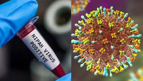 24 घंटे निगरानी में निपाह संक्रमित दो नर्सें, हालत अब भी गंभीर