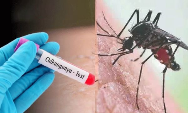 तमिलनाडु में कई जिलाें में बढ़ा चिकनगुनिया संक्रमण, जनस्वास्थ्य विभाग ने जारी एडवाइजरी