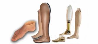 सहायक प्रौद्योगिकी पर भारत का दृष्टिकोण और क्षमता