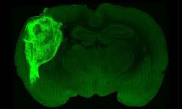  मानव मस्तिष्क ऑर्गेनॉइड का चूहों में प्रत्यारोपण
