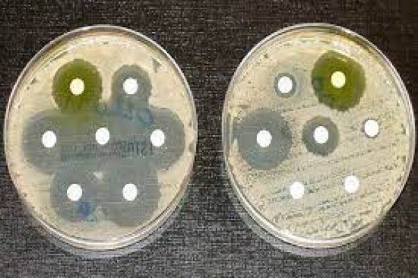  रोगाणुओं के अध्ययन की उच्च-सुरक्षा प्रयोगशालाओं में वृद्धि